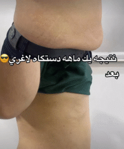 نمونه لاغری کلینیک اکسیر جوانی سایه