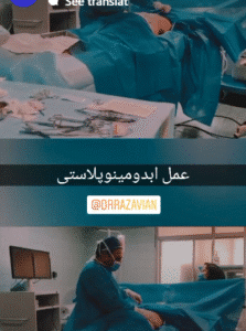 نمونه جراحی لاغری دکتر حسین رضویان