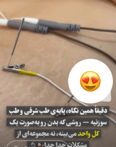 نمونه طب سوزنی دکتر لیلی حمیدنیا