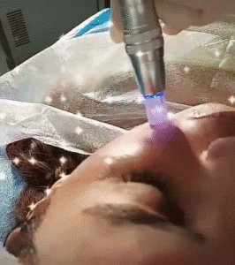 نمونه مزونیدلینگ کلینیک گلدن رویال