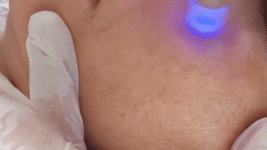 نمونه مزونیدلینگ کلینیک گلدن رویال