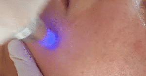 نمونه مزونیدلینگ کلینیک گلدن رویال