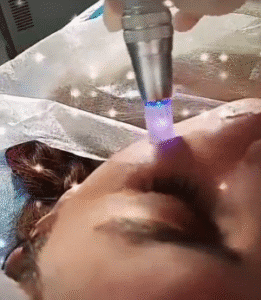 نمونه مزونیدلینگ کلینیک گلدن رویال