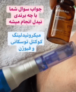 نمونه مزونیدلینگ کلینیک گلدن رویال