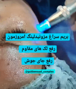 نمونه مزونیدلینگ کلینیک گلدن رویال