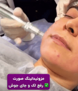 نمونه مزونیدلینگ کلینیک گلدن رویال