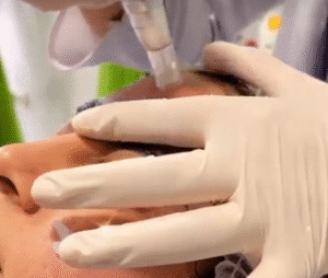 نمونه مزونیدلینگ کلینیک گلدن رویال