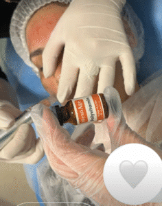 نمونه مزونیدلینگ کلینیک گلدن رویال