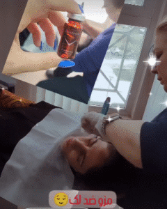 نمونه مزونیدلینگ دکتر مژگان کلالی