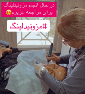 نمونه مزونیدلینگ دکتر مژگان کلالی