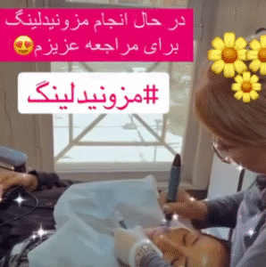 نمونه مزونیدلینگ دکتر مژگان کلالی