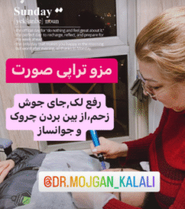 نمونه مزونیدلینگ دکتر مژگان کلالی