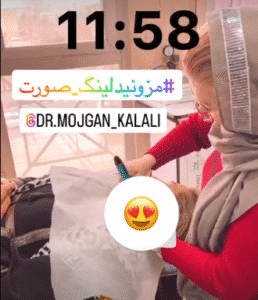 نمونه مزونیدلینگ دکتر مژگان کلالی