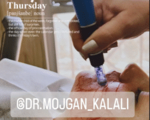 نمونه مزونیدلینگ دکتر مژگان کلالی