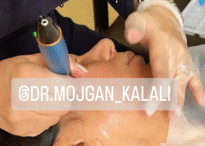 نمونه مزونیدلینگ دکتر مژگان کلالی