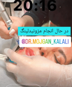 نمونه مزونیدلینگ دکتر مژگان کلالی