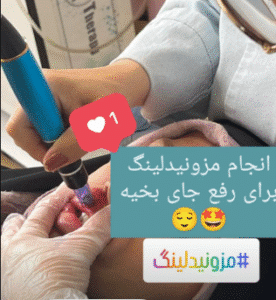 نمونه مزونیدلینگ دکتر مژگان کلالی