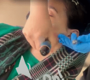 نمونه مزونیدلینگ دکتر مژگان کلالی