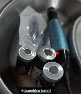 نمونه مزونیدلینگ دکتر مژگان کلالی