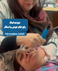 نمونه مزونیدلینگ دکتر مژگان کلالی