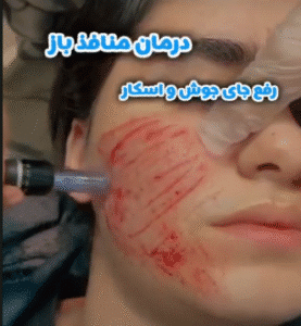 نمونه مزونیدلینگ دکتر مژگان کلالی