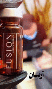 نمونه مزونیدلینگ کلینیک زیبایی آرمان