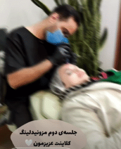 نمونه مزونیدلینگ کلینیک زیبایی آرمان