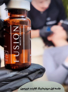 نمونه مزونیدلینگ کلینیک زیبایی آرمان