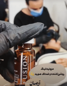 نمونه مزونیدلینگ کلینیک زیبایی آرمان