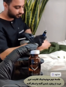 نمونه مزونیدلینگ کلینیک زیبایی آرمان