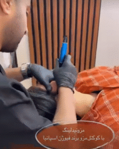 نمونه مزونیدلینگ کلینیک زیبایی آرمان