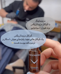 نمونه مزونیدلینگ کلینیک زیبایی آرمان