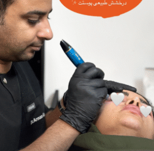 نمونه مزونیدلینگ کلینیک زیبایی آرمان