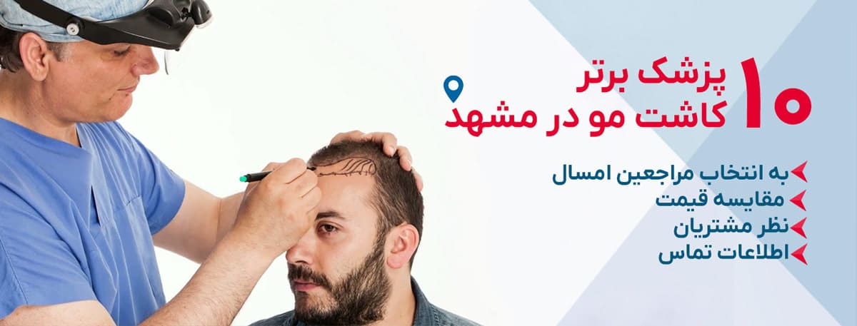 بهترین مرکز کاشت مو در مشهد